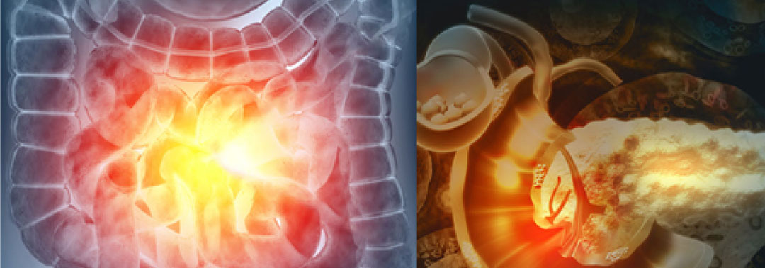 XV Jornada de Avances en Gastroenterología y Hepatología
